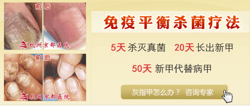 ڻָ